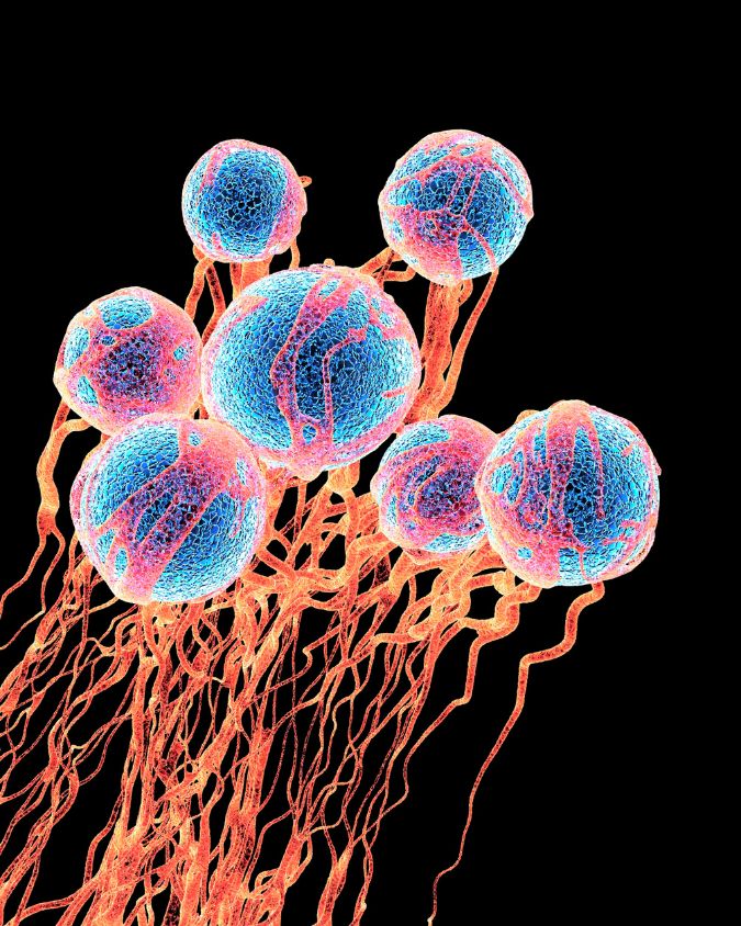 Microscopic close-up of spherical cancer cells with branching structures, digitally enhanced in blue and red to show cellular detail, symbolizing the science behind holistic and complementary cancer support therapies.